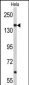 NUP153 Antibody (N-term)